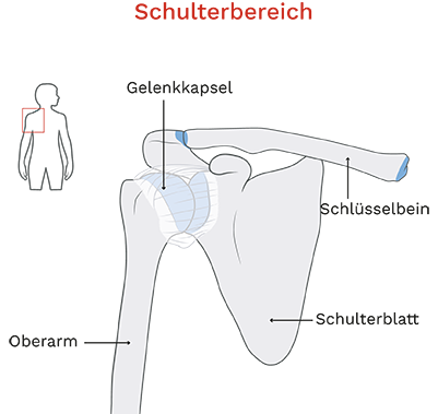 Crushing Oder Impingement Der Schulter | Bergman Clinics