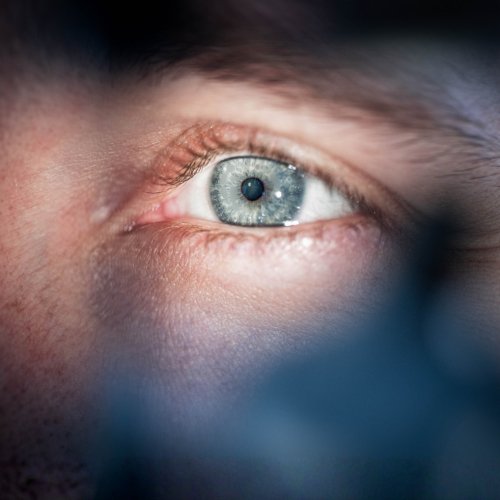 Altersbedingte Makuladegeneration (AMD)