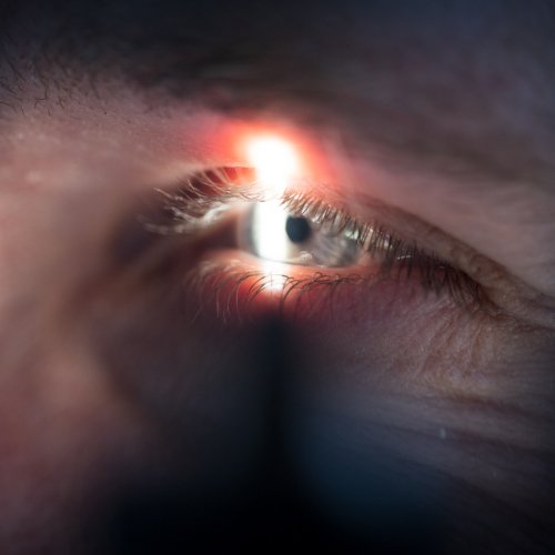 Trockenes Auge